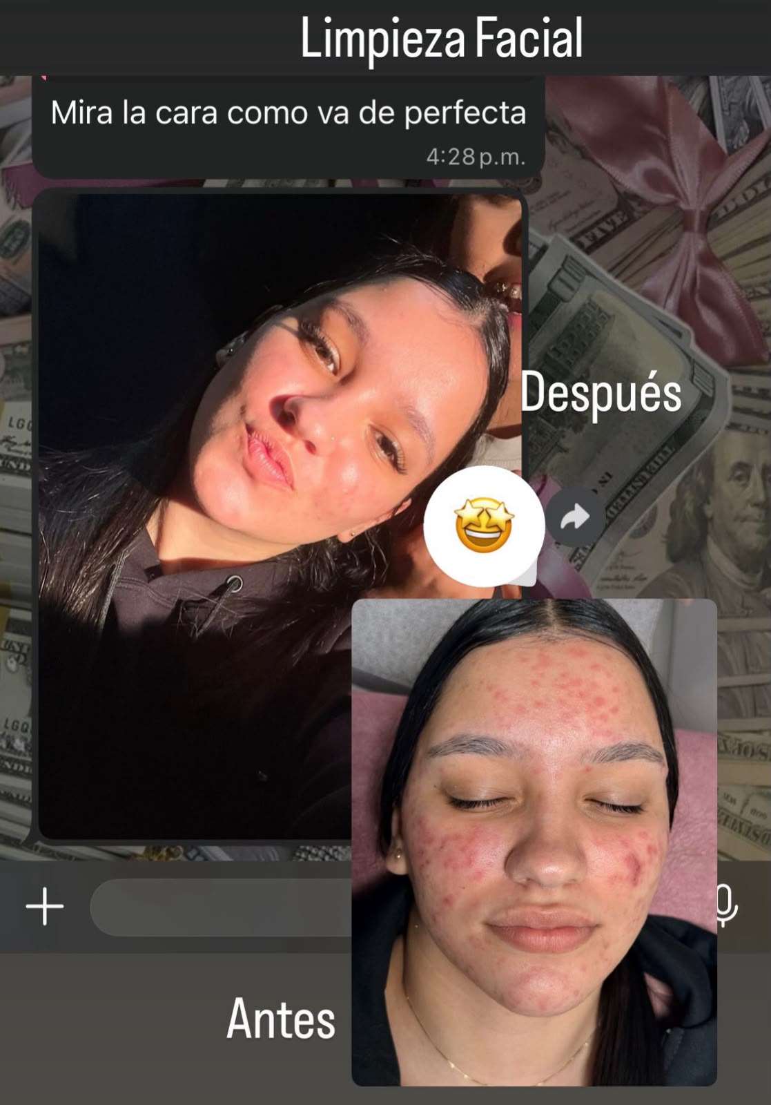 Reseña real de clienta sobre limpieza facial, antes y después